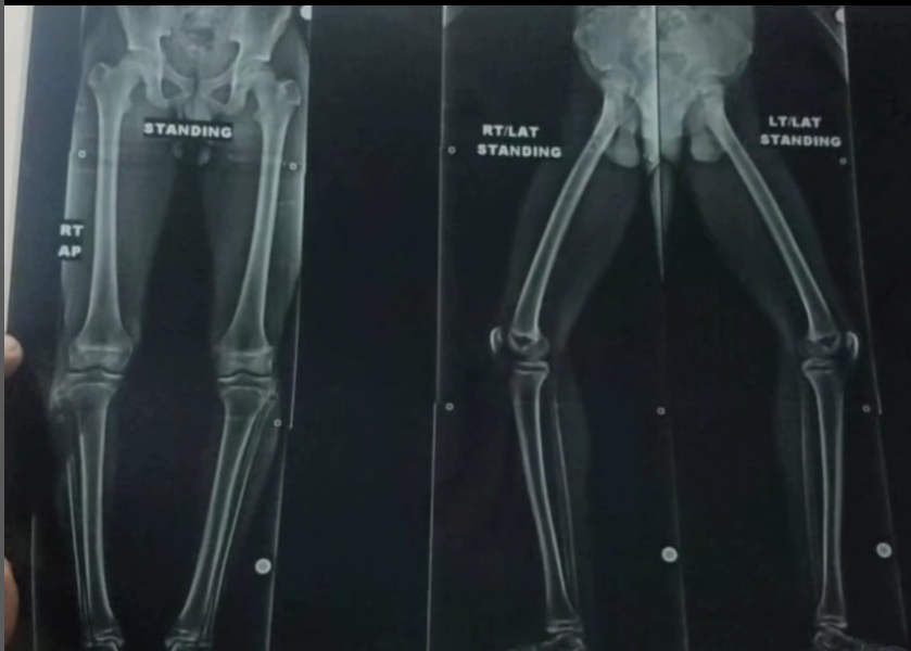 Case Study 8 - Cupping Therapy